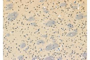 ABIN6261295 and ABIN6273110 at 1/100 staining Mouse brain tissue by IHC-P. (DHX9 抗体  (C-Term))