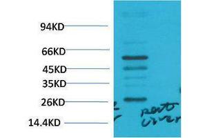 Western Blotting (WB) image for anti-Transforming Growth Factor, beta 1 (TGFB1) antibody (ABIN3181581) (TGFB1 抗体)