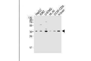 All lanes : Anti-Z Antibody (C-term) at 1:2000 dilution Lane 1: HepG2 whole cell lysate Lane 2: K562 whole cell lysate Lane 3: U-87MG whole cell lysate Lane 4: HL-60 whole cell lysate Lane 5: CCRF-CEM whole cell lysate Lane 6: Human brain whole tissue lysate Lysates/proteins at 20 μg per lane. (MPZ 抗体  (C-Term))