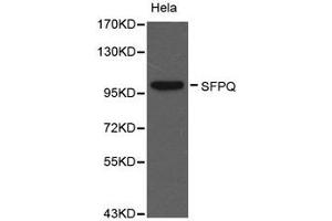 Western Blotting (WB) image for anti-Splicing Factor Proline/glutamine-Ric (SFPQ) antibody (ABIN1874752) (SFPQ 抗体)
