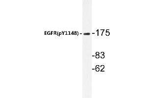 Western blot (WB) analyzes of p-EGFR antibody in extracts from HepG2 cells. (EGFR 抗体  (pTyr1172))