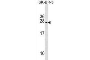 Western Blotting (WB) image for anti-Tumor Suppressor Candidate 5 (TUSC5) antibody (ABIN2999811) (TUSC5 抗体)