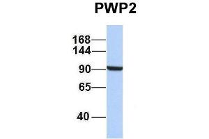 Host:  Rabbit  Target Name:  PWP2  Sample Type:  Jurkat  Antibody Dilution:  1. (PWP2 抗体  (Middle Region))
