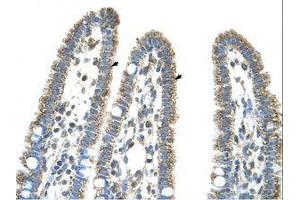 Image no. 1 for anti-Carbamoyl-Phosphate Synthase 1, Mitochondrial (CPS1) (AA 951-1000) antibody (ABIN320972) (CPS1 抗体  (AA 951-1000))