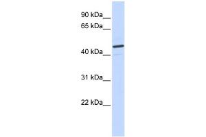 WB Suggested Anti-CATSPER2 Antibody Titration:  0. (CATSPER2 抗体  (N-Term))
