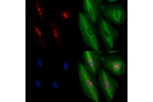 ABIN6263450 and ABIN6278413 staining  cells by IF/ICC. (MYBBP1A 抗体  (C-Term))