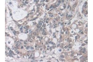 Immunohistochemistry (IHC) image for anti-Guanidinoacetate N-Methyltransferase (GAMT) (AA 64-236) antibody (ABIN7444169)