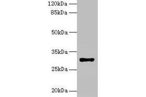 Western blot All lanes: HLA-DRB4 antibody at 2 μg/mL + Raji whole cell lysate Secondary Goat polyclonal to rabbit IgG at 1/10000 dilution Predicted band size: 30 kDa Observed band size: 30 kDa (HLA-DRB4 抗体  (AA 30-227))