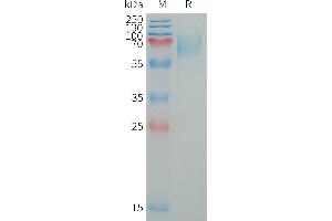 Human LI Protein, His Tag on SDS-PAGE under reducing condition.