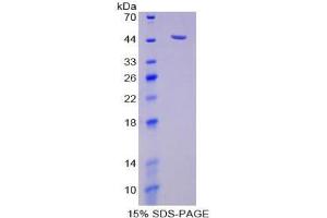 SDS-PAGE analysis of Human Neuraminidase Protein.