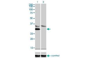 Western blot analysis of LDB3 over-expressed 293 cell line, cotransfected with LDB3 Validated Chimera RNAi (Lane 2) or non-transfected control (Lane 1).