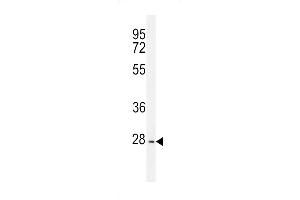 PTPN20A Antibody (Center) (ABIN655743 and ABIN2845189) western blot analysis in K562 cell line lysates (35 μg/lane). (PTPN20A 抗体  (AA 178-207))