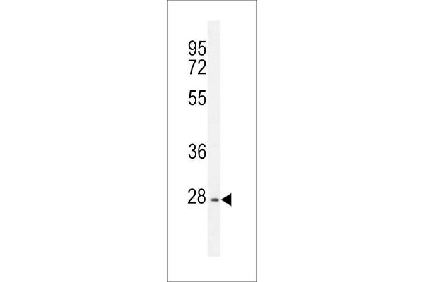 PTPN20A anticorps  (AA 178-207)
