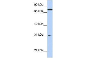 MAP4K1 antibody used at 1 ug/ml to detect target protein. (MAP4K1 抗体  (N-Term))