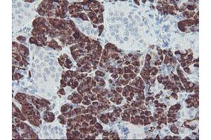 Image no. 1 for anti-Carboxypeptidase A2 (Pancreatic) (CPA2) antibody (ABIN1497595) (Carboxypeptidase A2 抗体)