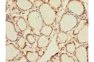 Immunohistochemistry of paraffin-embedded human thyroid tissue using ABIN7168008 at dilution of 1:100 (RHOBTB1 抗体  (AA 240-400))
