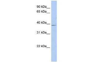 WB Suggested Anti-SLC25A28 Antibody Titration:  0. (SLC25A28 抗体  (Middle Region))