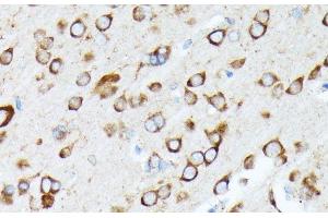 Immunohistochemistry of paraffin-embedded Rat brain using RPL7 Polyclonal Antibody at dilution of 1:100 (40x lens). (RPL7 抗体)