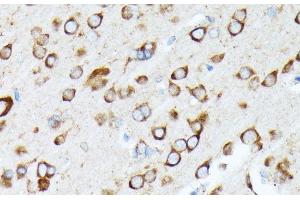 Immunohistochemistry of paraffin-embedded Rat brain using RPL7 Polyclonal Antibody at dilution of 1:100 (40x lens).