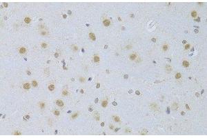 Immunohistochemistry of paraffin-embedded Rat brain using CDKN1A Polyclonal Antibody at dilution of 1:100 (40x lens). (p21 抗体)