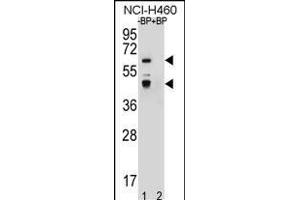 Western blot analysis of PREF3 Antibody (C-term) Pab (ABIN656587 and ABIN2845849) pre-incubated without(lane 1) and with(lane 2) blocking peptide in NCI- cell line lysate. (PRAMEF3 抗体  (C-Term))