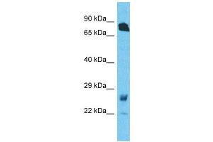 Western Blotting (WB) image for anti-Ras Homolog Gene Family, Member T1 (RHOT1) (N-Term) antibody (ABIN2782020)