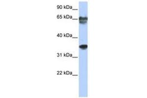 Image no. 1 for anti-NK3 Homeobox 2 (NKX3-2) (N-Term) antibody (ABIN6740332) (NKX3-2 抗体  (N-Term))