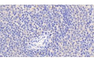 Detection of Bid in Human Spleen Tissue using Polyclonal Antibody to BH3 Interacting Domain Death Agonist (Bid) (BID 抗体  (AA 1-195))