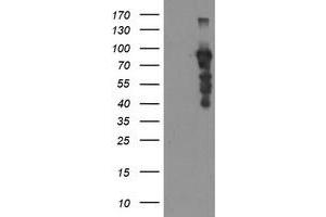 Western Blotting (WB) image for anti-SRY (Sex Determining Region Y)-Box 5 (SOX5) antibody (ABIN1501083) (SOX5 抗体)