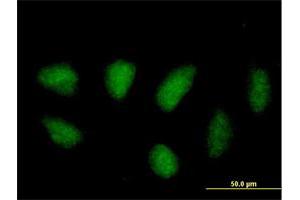 Immunofluorescence of purified MaxPab antibody to MAPK11 on HeLa cell. (MAPK11 抗体  (AA 1-364))