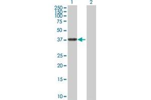 Western Blot analysis of ALDH3B2 expression in transfected 293T cell line by ALDH3B2 MaxPab polyclonal antibody. (ALDH3B2 抗体  (AA 1-385))