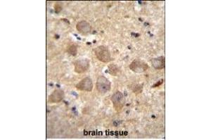 Immunohistochemistry (Paraffin-embedded Sections) (IHC (p)) image for anti-Protocadherin alpha Subfamily C, 2 (PCDHAC2) (AA 616-644) antibody (ABIN656091)