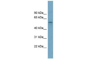 WB Suggested Anti-SLC22A15 Antibody Titration:  0. (SLC22A15 抗体  (Middle Region))