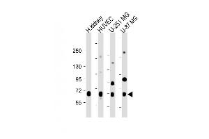 All lanes : Anti-NOX4 Antibody (N-term) at 1:2000 dilution Lane 1: Human kidney lysate Lane 2: HUVEC whole cell lysate Lane 3: U-251 MG whole cell lysate Lane 4: U-87 MG whole cell lysate Lysates/proteins at 20 μg per lane. (NADPH Oxidase 4 抗体  (N-Term))