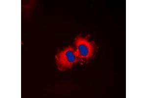 Immunofluorescent analysis of ALDH1A2 staining in HepG2 cells. (ALDH1A2 抗体  (C-Term))