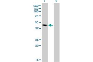 Western Blot analysis of T expression in transfected 293T cell line by T monoclonal antibody (M01), clone 5H8.
