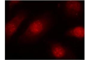 Image no. 3 for anti-Retinoblastoma 1 (RB1) (pSer780) antibody (ABIN196842)