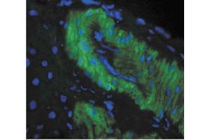 Immunohistochemistry analysis using Mouse Anti-Nitrotyrosine Monoclonal Antibody, Clone 39B6 . (Nitrotyrosine 抗体  (FITC))