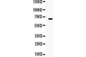 Observed bind size: 66KD (Butyrylcholinesterase 抗体  (AA 263-571))