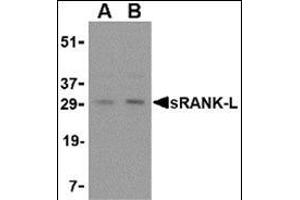 Western blot analysis of sRANK-L in rat liver tissue lysate with this product at (A) 0. (RANKL 抗体  (Center))