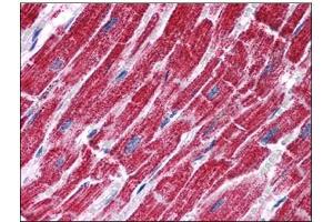 Human Heart: Formalin-Fixed, Paraffin-Embedded (FFPE) (FH 抗体  (Internal Region))