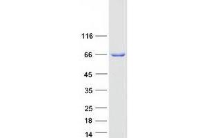 Western Blotting (WB) image for Golgi-Associated, gamma Adaptin Ear Containing, ARF Binding Protein 2 (GGA2) protein (Myc-DYKDDDDK Tag) (ABIN2721857)