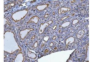 IHC analysis of P Glycoprotein/ABCB1 using anti-P Glycoprotein/ABCB1 antibody (ABIN7599525).