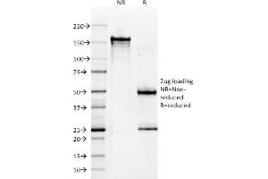 SDS-PAGE Analysis Purified HLA-A Mouse Monoclonal Antibody (108-2C5). (HLA-A 抗体)