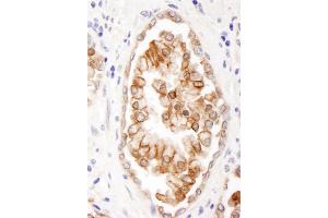 anti-ATP-Binding Cassette, Sub-Family B (MDR/TAP), Member 9 (ABCB9) (AA 475-525) antibody