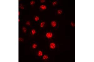 Immunofluorescent analysis of CDC16 staining in HeLa cells. (CDC16 抗体  (C-Term))