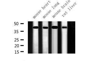 Western blot analysis of ILKAP expression in various lysates (ILKAP 抗体  (N-Term))