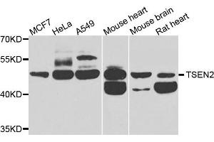 Western blot analysis of extracts of various cells, using TSEN2 antibody. (TSEN2 抗体)