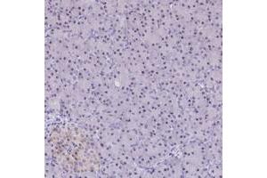 Immunohistochemical staining of human pancreas with C3orf26 polyclonal antibody  shows moderate nucleolar positivity in exocrine glandular cells at 1:200-1:500 dilution. (CMSS1 抗体)