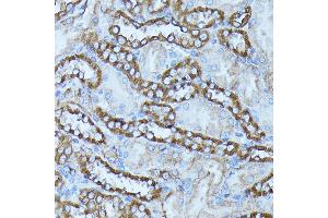 Immunohistochemistry of paraffin-embedded rat kidney using FGD1 antibody (ABIN7267284) at dilution of 1:100 (40x lens). (FGD1 抗体  (AA 700-800))